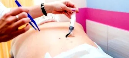 пијавици