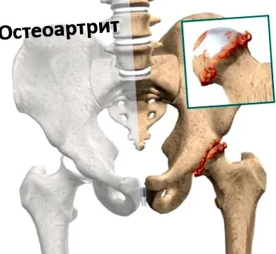 стопи стопи