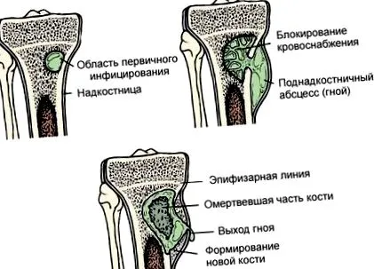 деформиращ стадий
