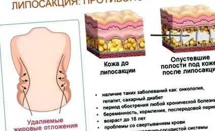 операции разходи