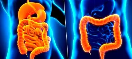 разлики болестта Crohn