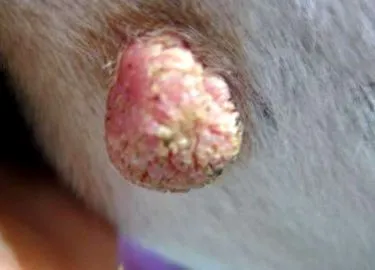 papilloma