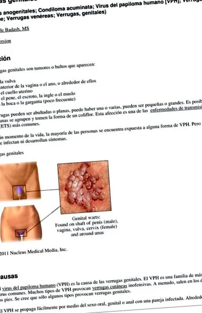 papilloma