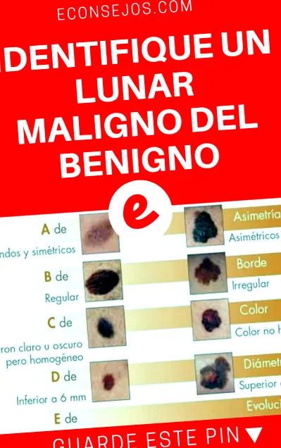 benigno