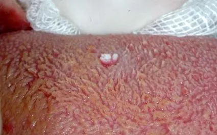 nyelv