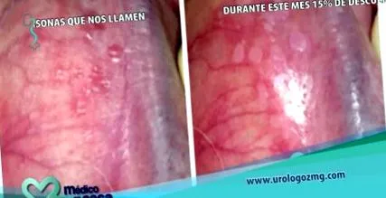 најдобар најдобар