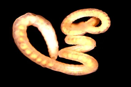 giardiasis