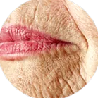 plasmage