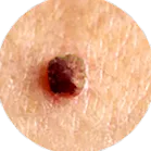 medical