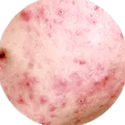 importőr