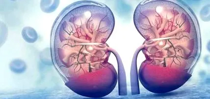 pyelonephritis