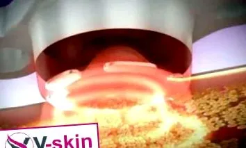 вакуум