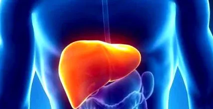 hepatitis