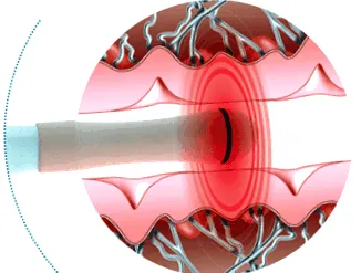 ultra