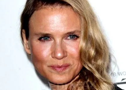 zellweger