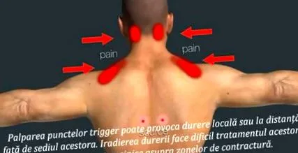vállízületi
