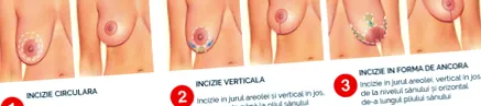 недели операцијата