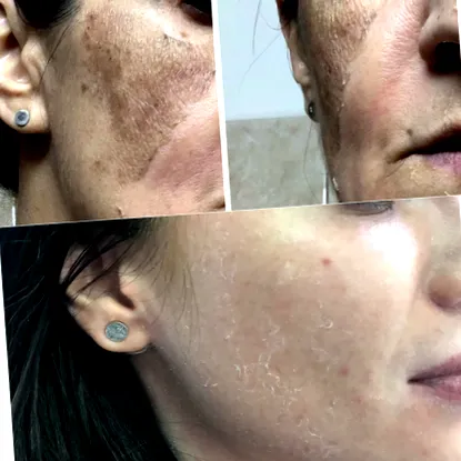 0000 http skinclinic