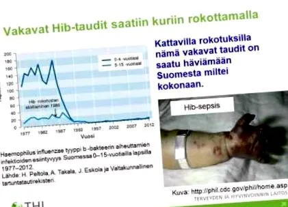 betegség hogyan alakul