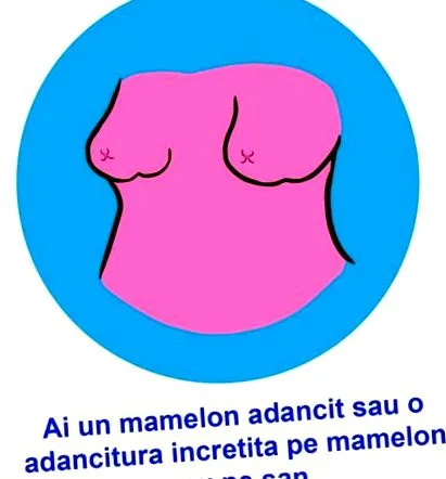 mondanak amit