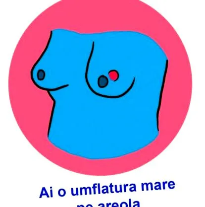 egészségedről melleid