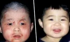 betegségek