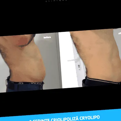 kezelés