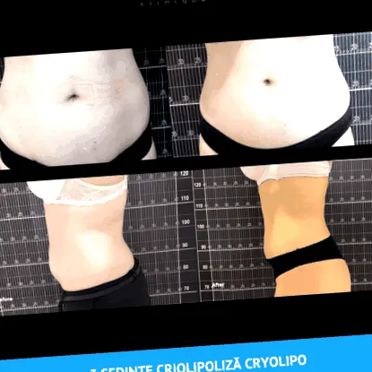 clinique