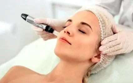 microneedling