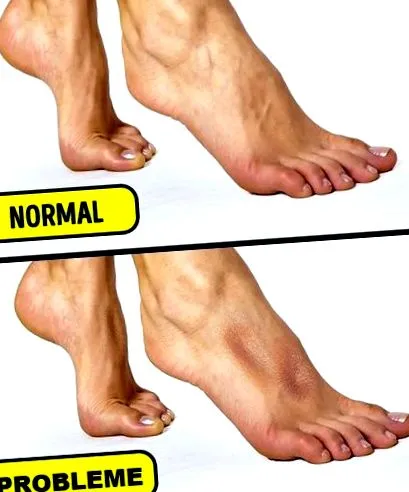 szép