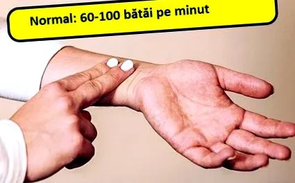 vonzó