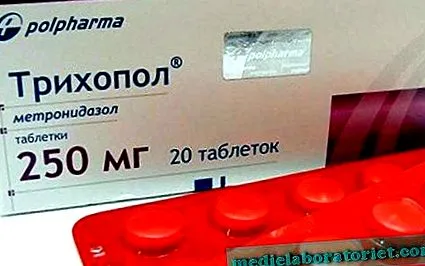зглобовите