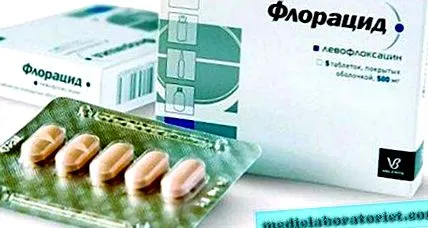 зглобовите