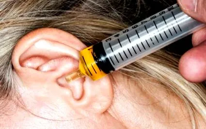 eldugult okok