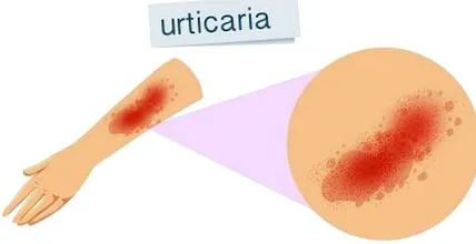prečo