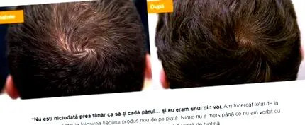 gyógyszertárakban vitahair