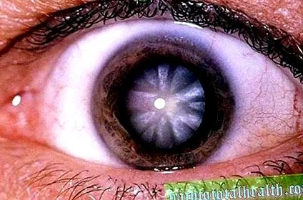 може бъде народни средства