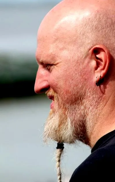 túlzott hajhullás alopecirea