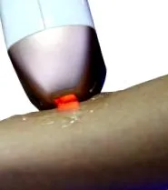 többhullámú lézerdiódás
