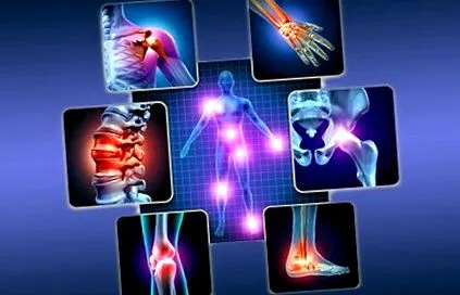 hasonlóságok rheumatoid