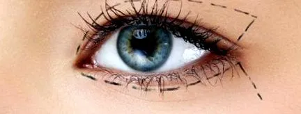 diantus