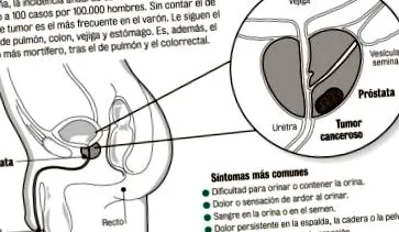 definíciós