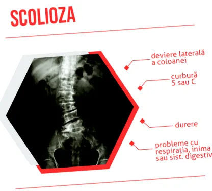 práce