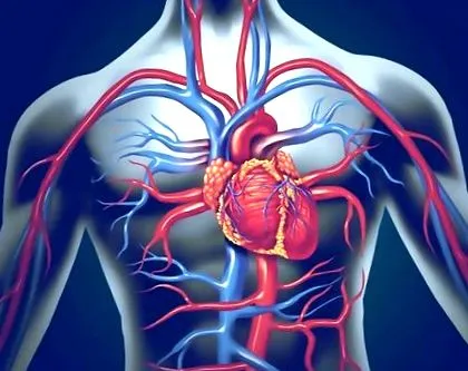 aorta aneurysma