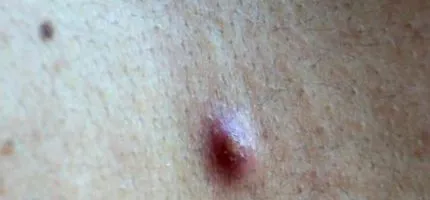 симптоми причини