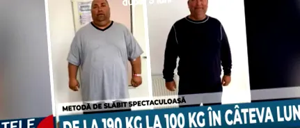 műtét bariatrikus