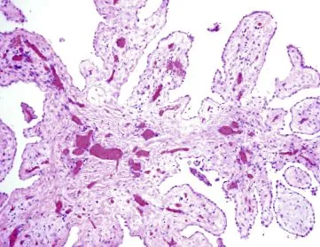 ceruza ceruza