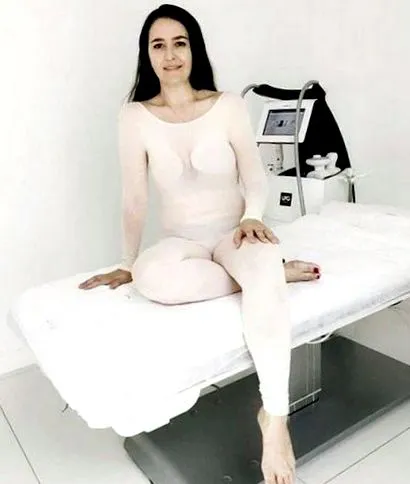 vyzerá