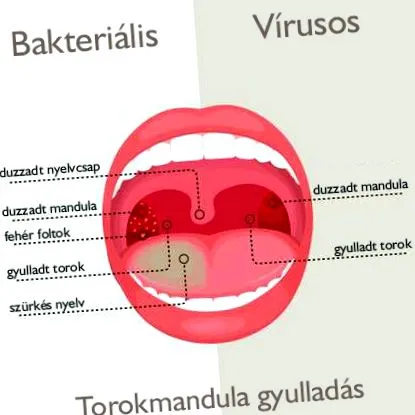 detoxifiere