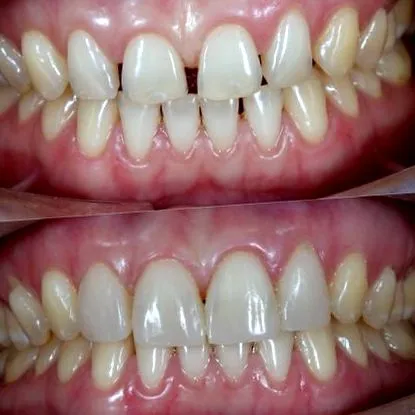 denttaglio